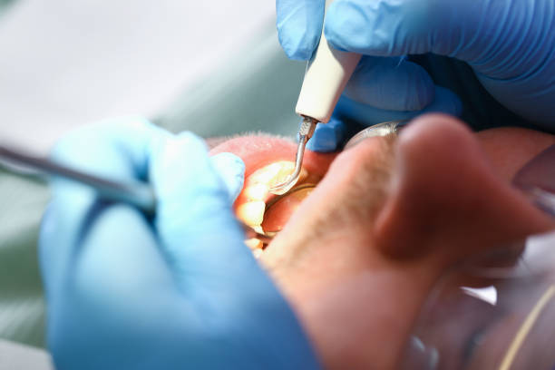 Best Emergency Broken Tooth Repair in Basking Ridge, NJ