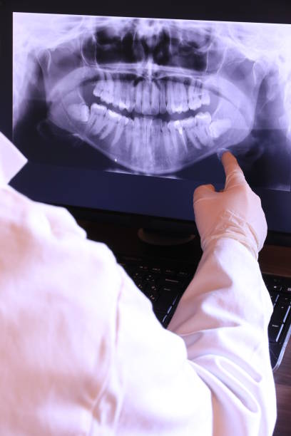 Best Emergency Tooth Extraction in Basking Ridge, NJ